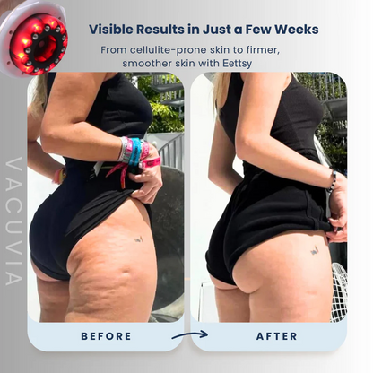 RadiancePulse™ — Unlock Silky, Sculpted Skin That Commands Confidence