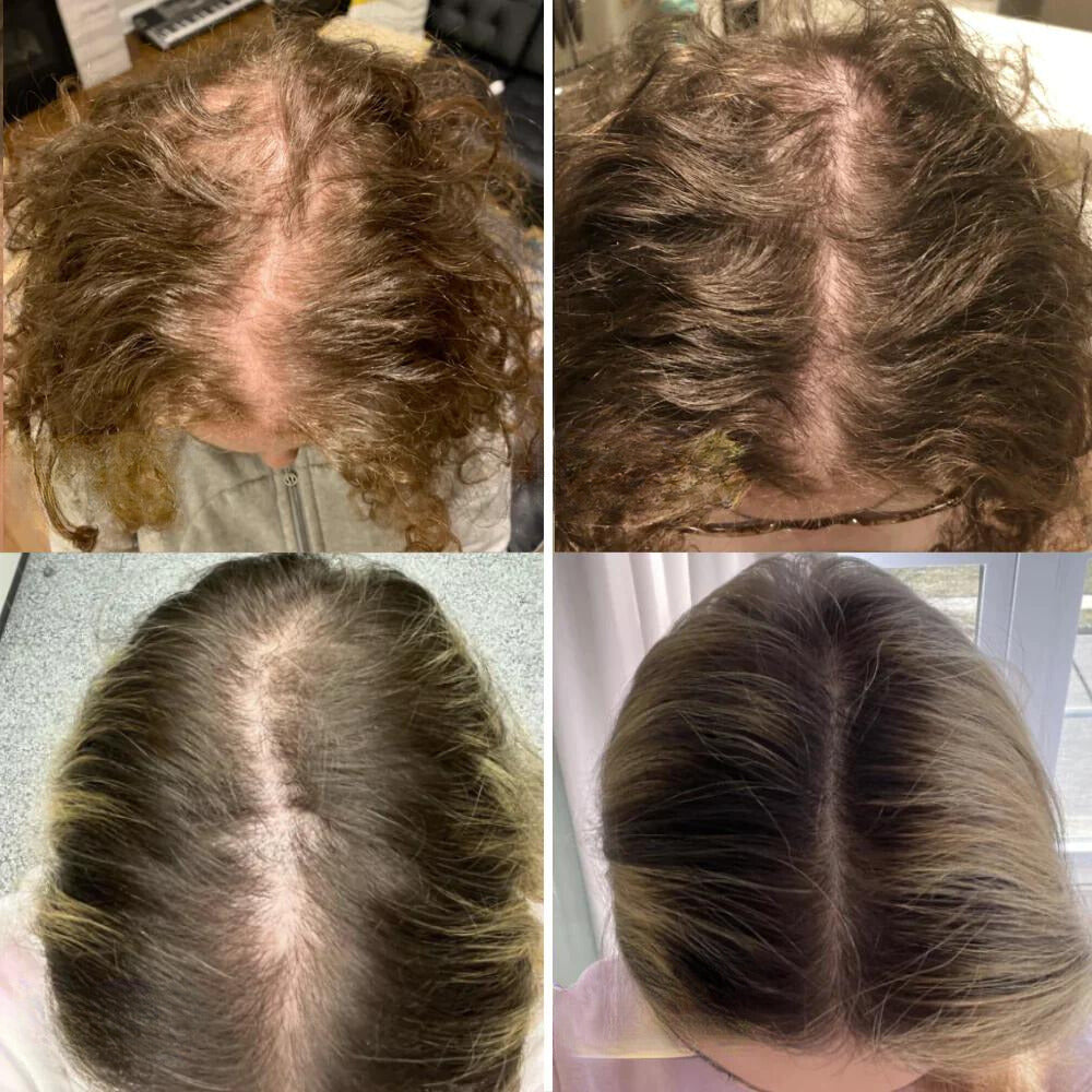 LuxaGrow™ — Unlock Thick, Radiant Hair That Commands Attention Every Day