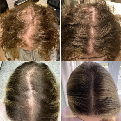 Verdanta™ — Ignite Your Scalp, Unlock Thicker, Fuller Hair That Commands Attention