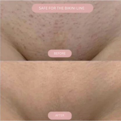 SilkSlide™ — Glide Pain-Free to Radiant, Bump-Free Skin You’ll Proudly Flaunt