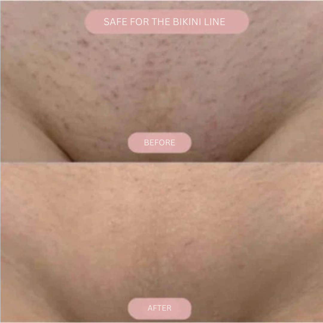 VelvaSmooth™ — Discover Silky, Bump-Free Skin and Unshakable Confidence
