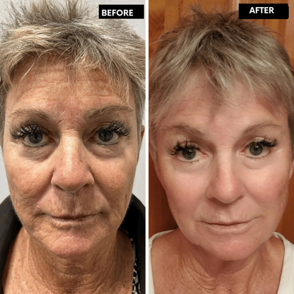 RadianceRush™ Retinal Serum — Unleash Silky, Youthful Skin That Commands Attention