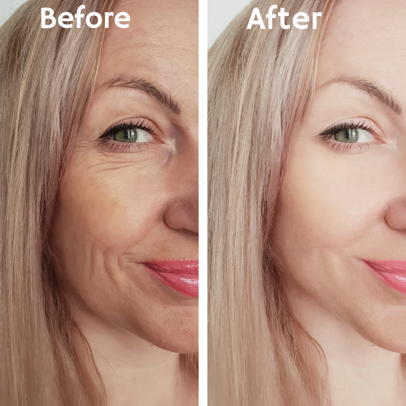 LumiraLift™ — Instantly Firm, Glow, and Transform Your Skin’s Youthful Spark