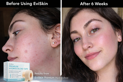 SolarisSkin™ — Fast-Acting Freedom to Reveal Your True, Radiant Glow