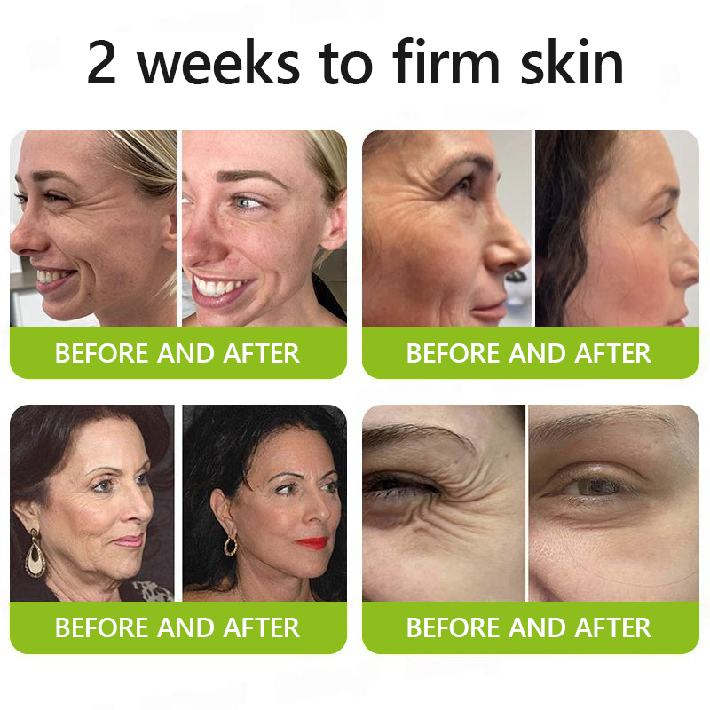 LumaLift™ — Wake Up to Instantly Firmer, Smoother, Radiant Skin That Turns Back Time