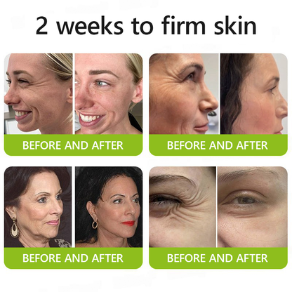 LumaLift™ — Wake Up to Instantly Firmer, Smoother, Radiant Skin That Turns Back Time
