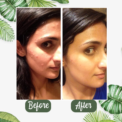Virella™ Detox Mask Stick — Unlock Radiant, Shine-Free Skin That Commands Attention