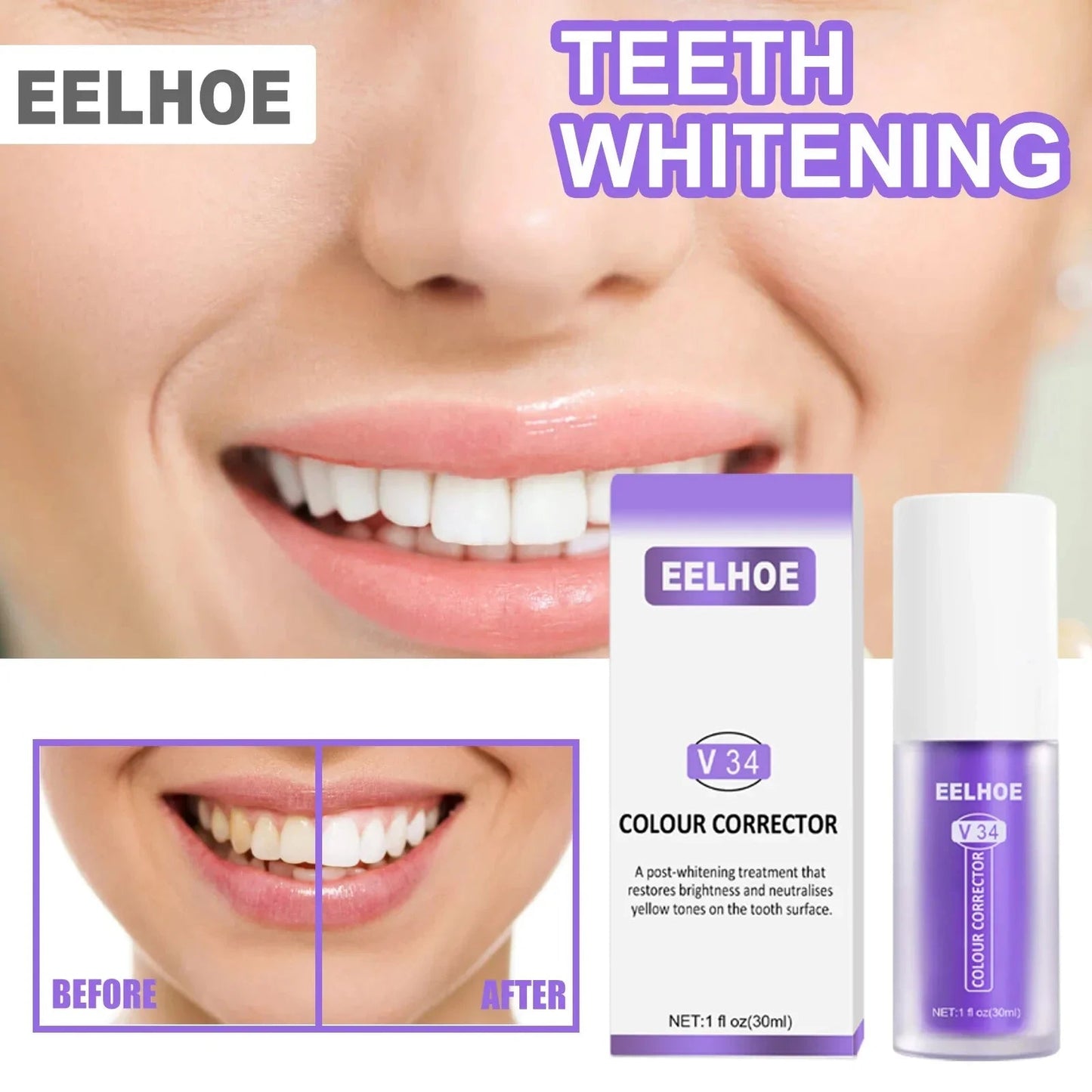 RadiantBeam™ — Instantly Brighten Your Smile Without Pain or Wait