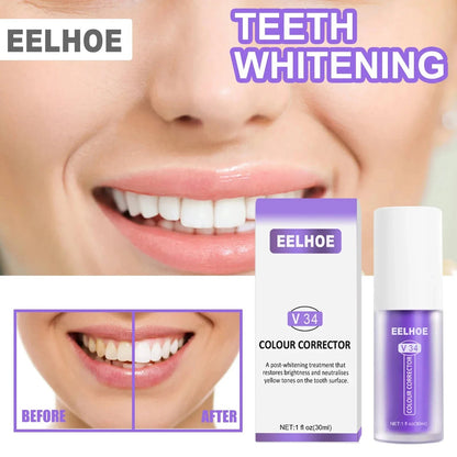 RadiantBeam™ — Instantly Brighten Your Smile Without Pain or Wait