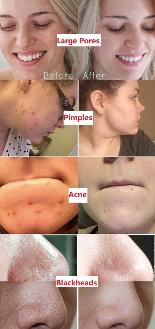 Virella™ Detox Mask Stick — Unlock Radiant, Shine-Free Skin That Commands Attention