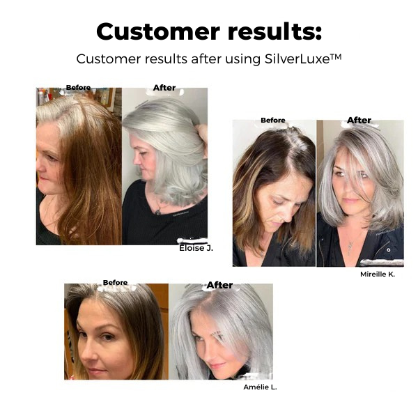 ArgentMist™ — Glow Boldly with Luminous, Damage-Free Silver Hair