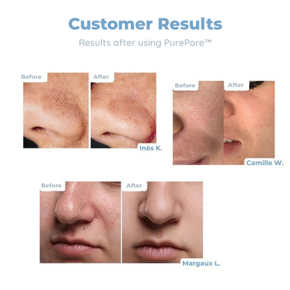 RadiantPore™ — Unleash Silky, Clear Skin That Lights Up Every Room