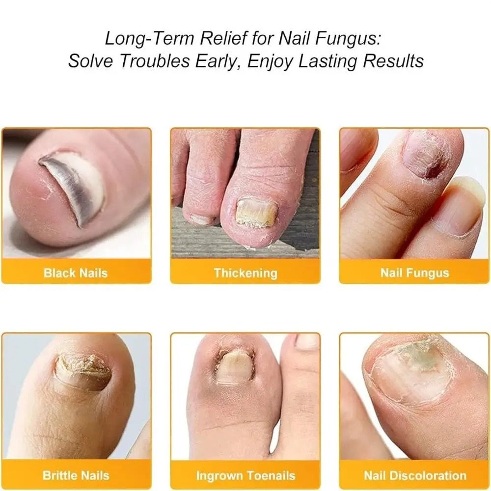 FungiClear™ — Transform Your Nails from Embarrassed to Unstoppably Confident