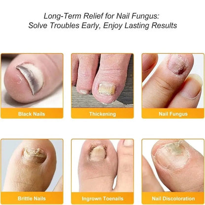 FungiClear™ — Transform Your Nails from Embarrassed to Unstoppably Confident