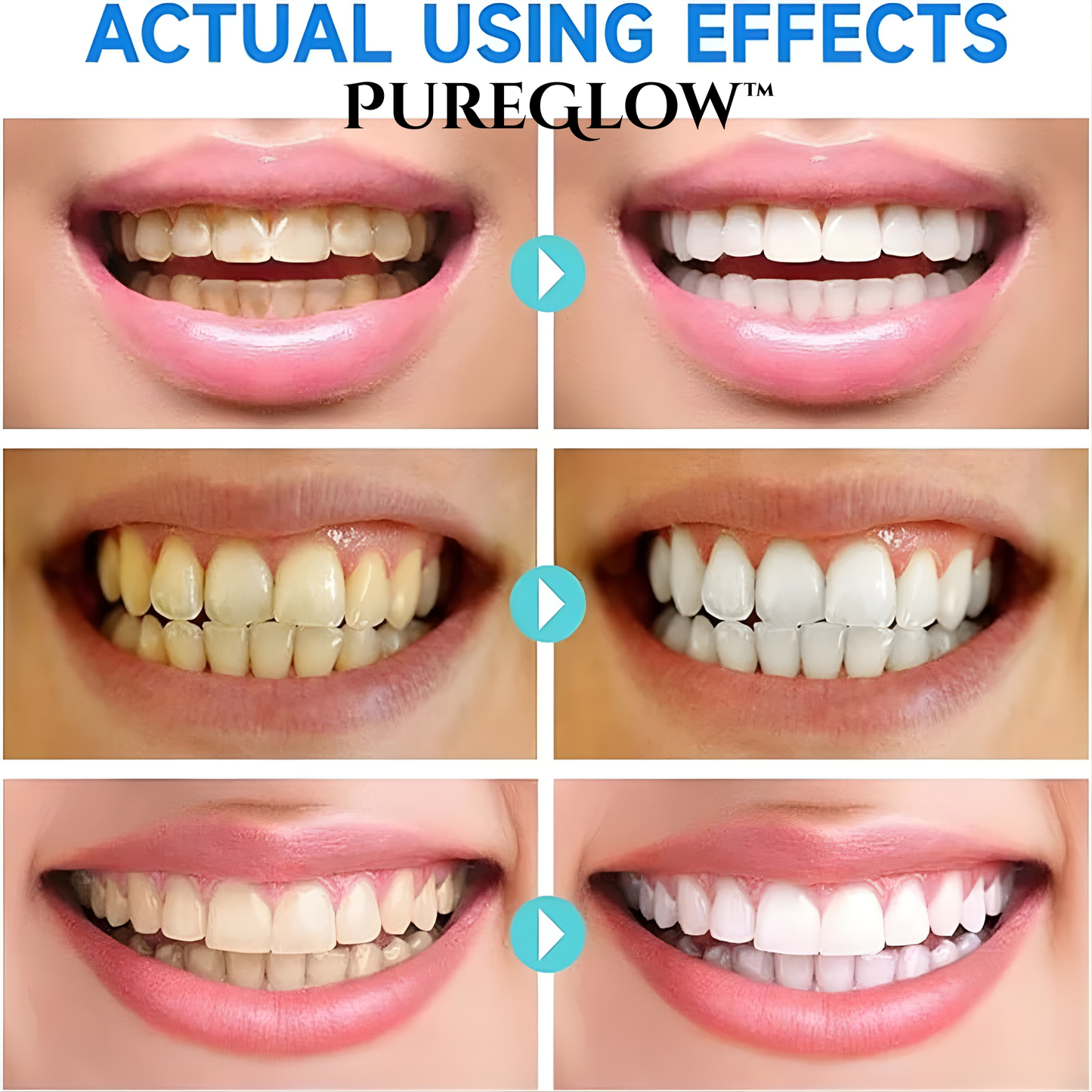 LumiDent™ — Ignite Your Smile’s True Brilliance and Strength Every Day