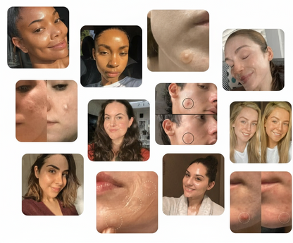 SolarisSkin™ — Fast-Acting Freedom to Reveal Your True, Radiant Glow