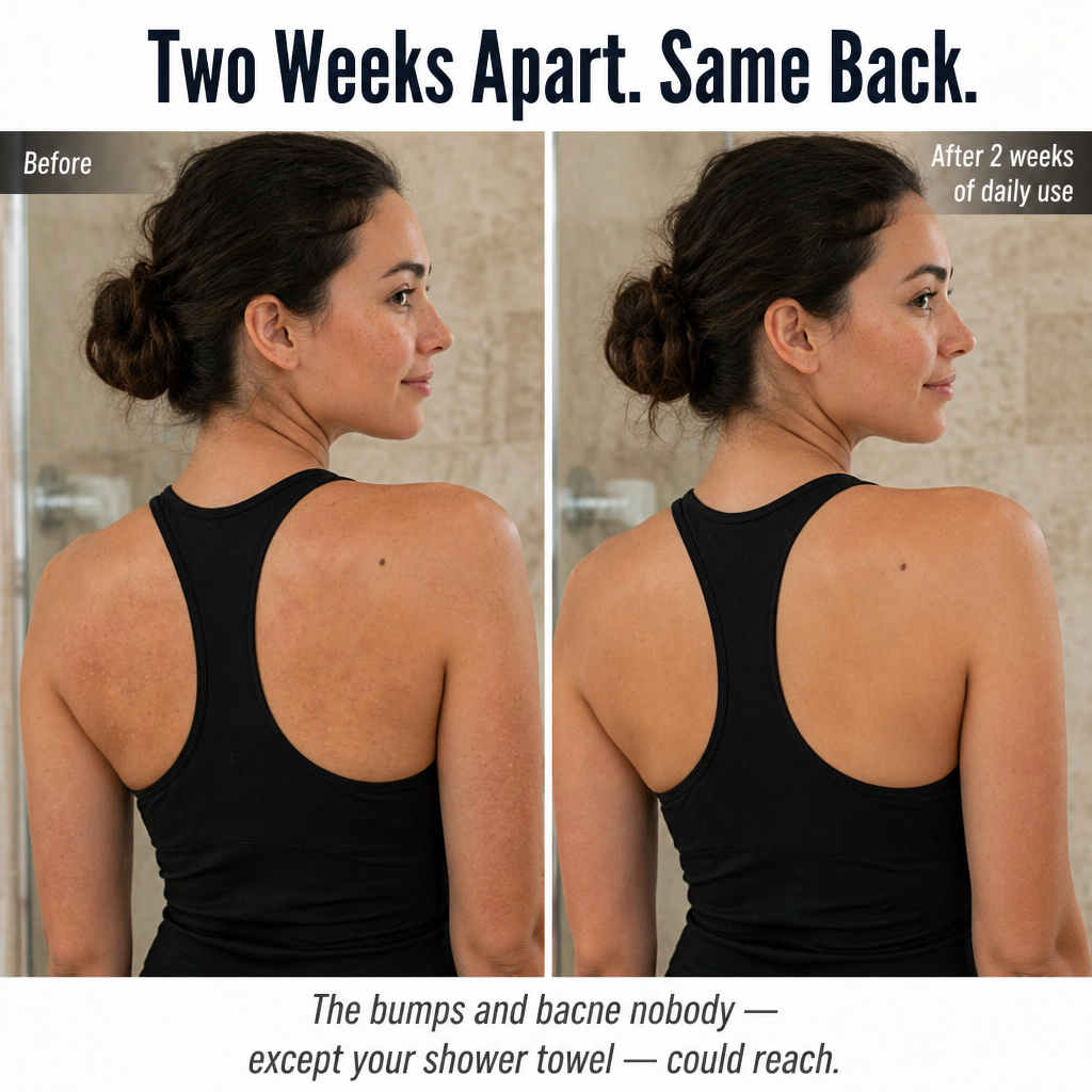 LuminaSheer™ — Clear Bacne, Back Bumps & Dead Skin Beyond a Loofah's Grip