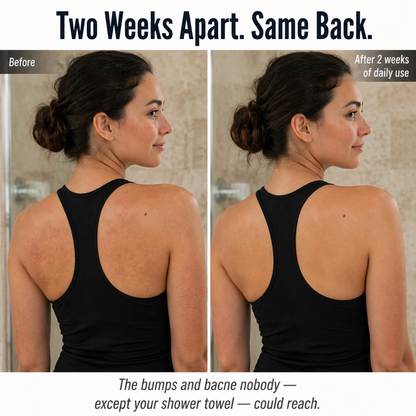 LuminaSheer™ — Clear Bacne, Back Bumps & Dead Skin Beyond a Loofah's Grip