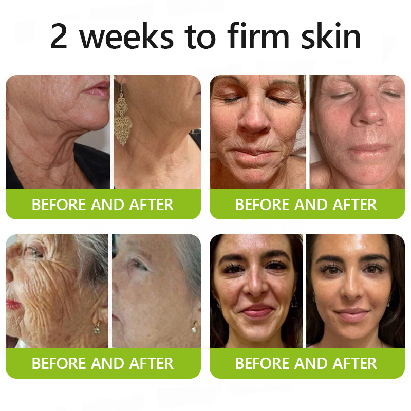 LumaLift™ — Wake Up to Instantly Firmer, Smoother, Radiant Skin That Turns Back Time