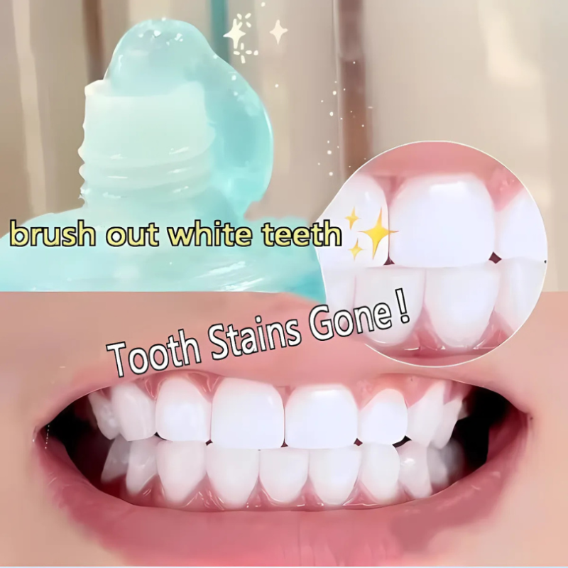 GlowLuxe™ Whitening Toothpaste — Unlock a Radiant, Pain-Free Smile That Turns Heads Every Day