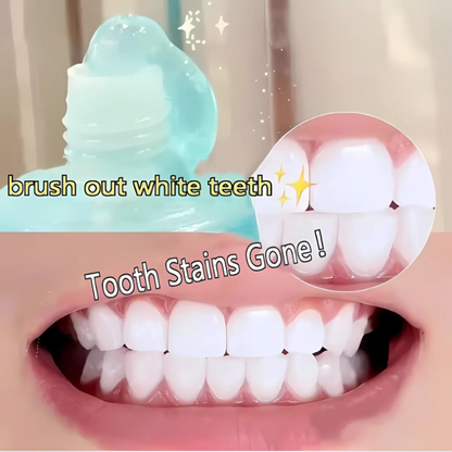 GlowLuxe™ Whitening Toothpaste — Unlock a Radiant, Pain-Free Smile That Turns Heads Every Day