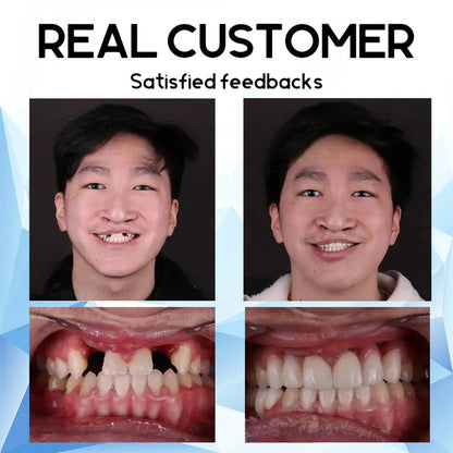 LunaSmile™ — Unlock Effortless Confidence with a Natural, Pain-Free Smile