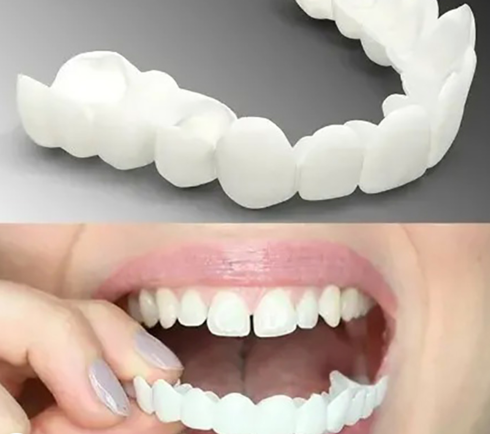 Adjustable Snap-On Dentures | Custom-Fit Removable Veneers | Easy Snap & Reusable