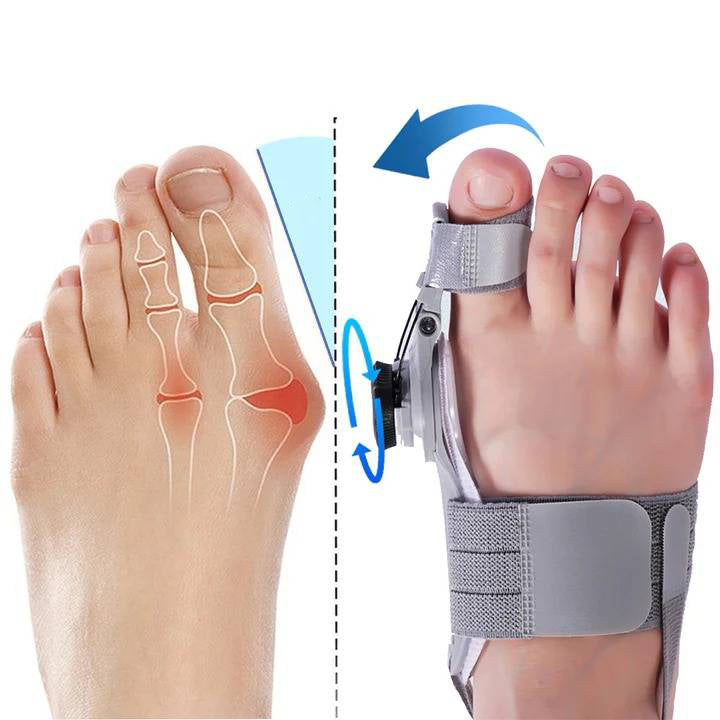 Bunion Corrector Toe Spacer | Adjustable Hinge Realignment | Silicone Pads & Heel Strap