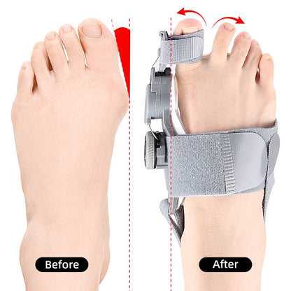 Bunion Corrector Toe Spacer | Adjustable Hinge Realignment | Silicone Pads & Heel Strap