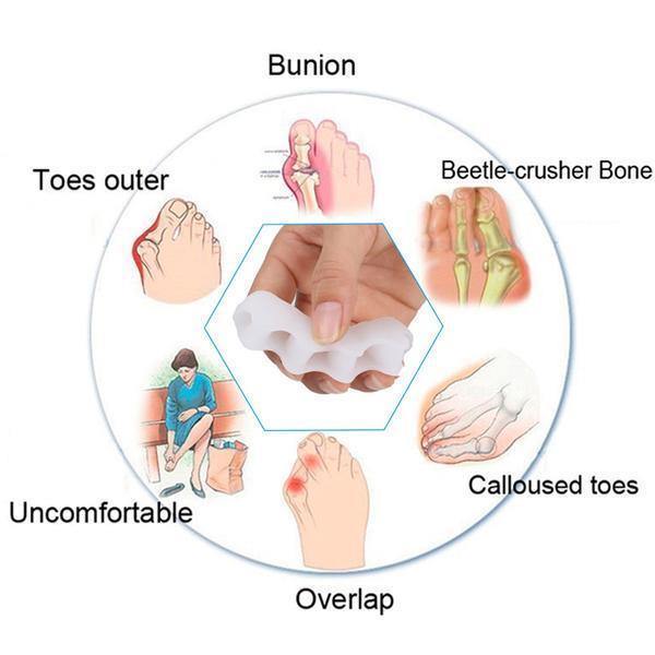 Orthopedic Toe Corrector | Adjustable Toe Separator | Soft Gel Sleeve | Pain Relief