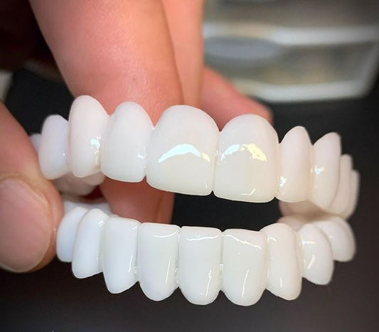 Removable Dental Veneer | Natural-Looking Custom Fit | Lightweight & Reusable | Daily Use