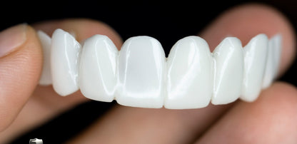 Removable Dental Veneer | Natural-Looking Custom Fit | Lightweight & Reusable | Daily Use