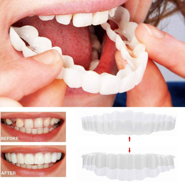 Removable Veneer Kit | Realistic Acrylic Resin Veneers | Upper & Lower Set | Comfortable Fit