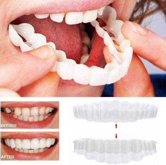 Removable Veneer Kit | Realistic Acrylic Resin Veneers | Upper & Lower Set | Comfortable Fit