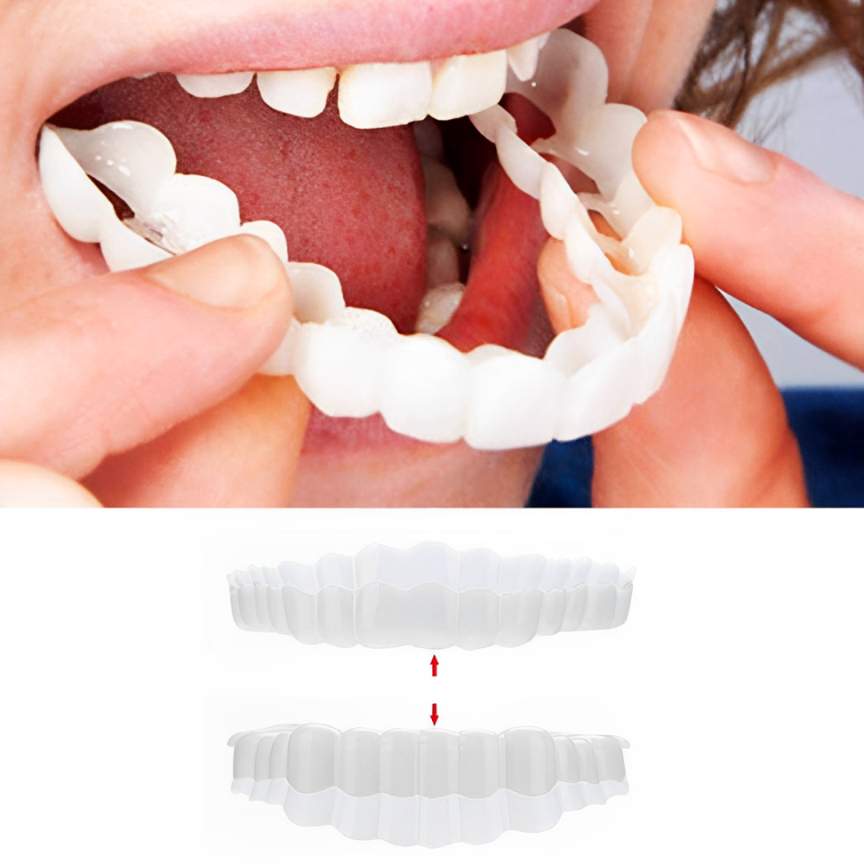 Snap-On Veneers (Upper & Lower) | Natural-Looking Finish | Silicone Liner | Comfortable Fit