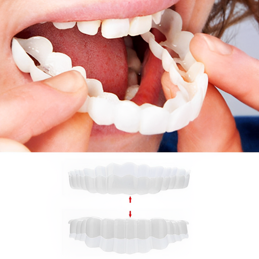Snap-On Veneers (Upper & Lower) | Natural-Looking Finish | Silicone Liner | Comfortable Fit