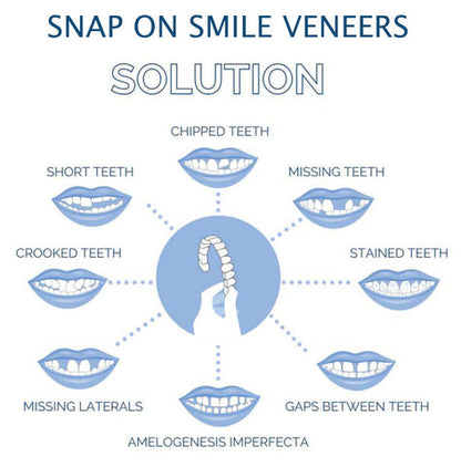 Snap-On Veneers (Upper & Lower) | Natural-Looking Finish | Silicone Liner | Comfortable Fit