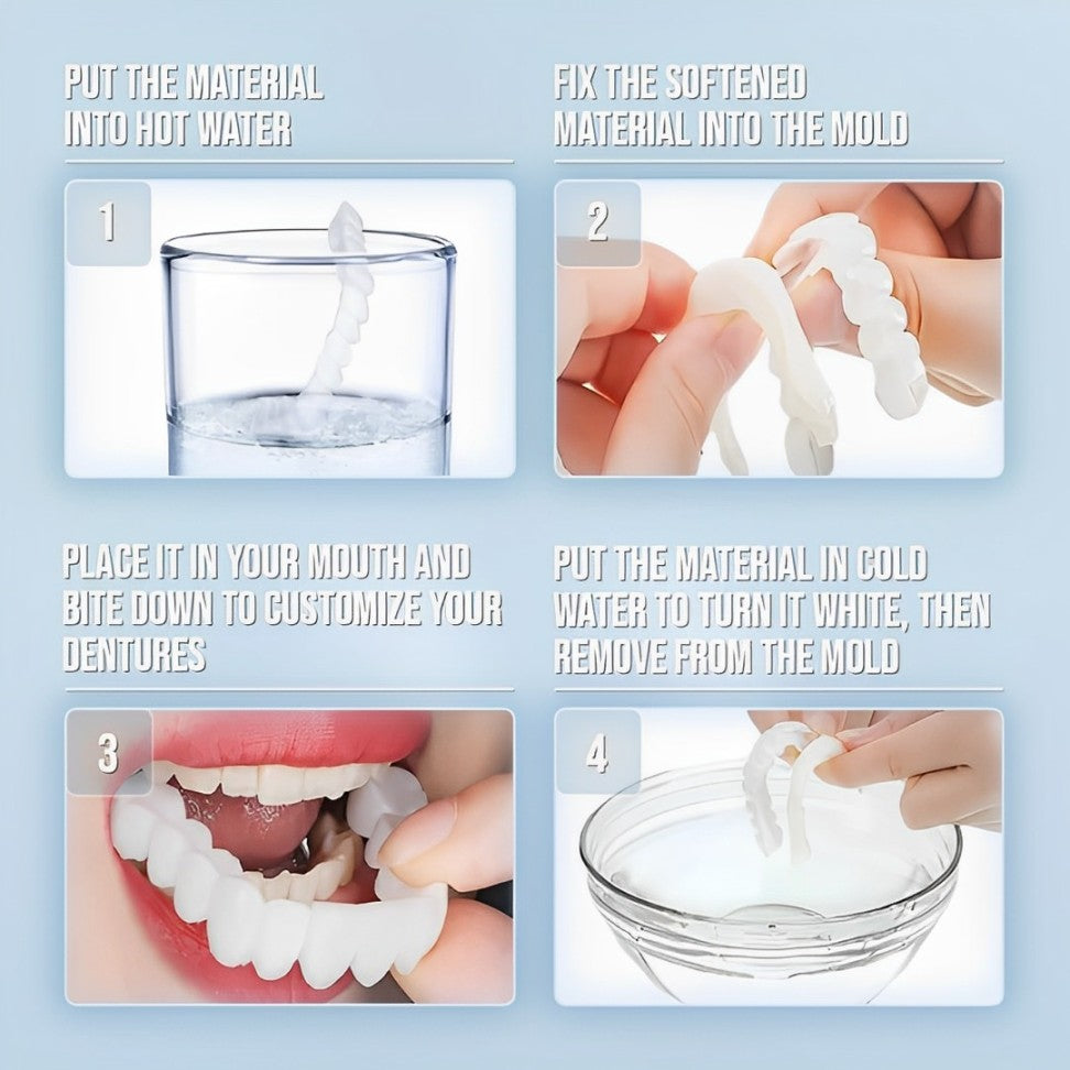 Snap-On Veneers (Upper & Lower) | Natural-Looking Finish | Silicone Liner | Comfortable Fit