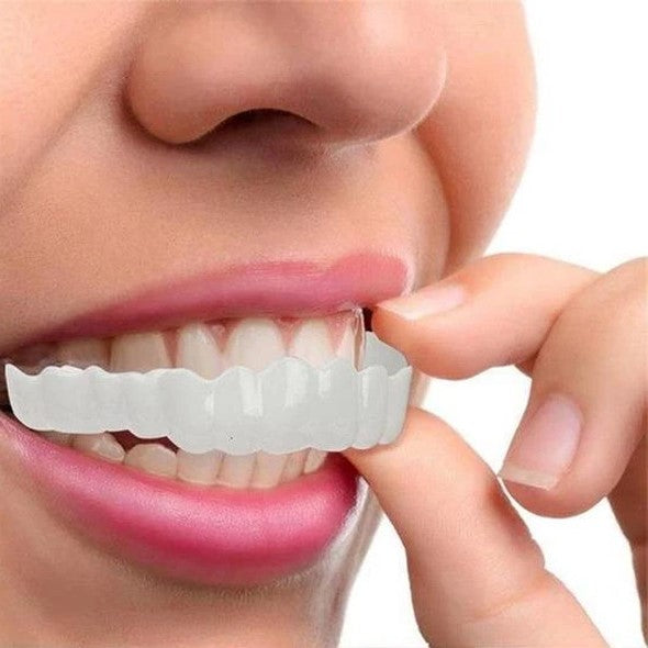 Snap-On Veneers (Upper & Lower) | Natural-Looking Finish | Silicone Liner | Comfortable Fit