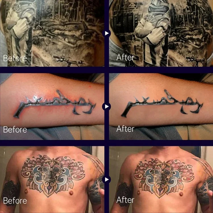 VividLock™ — Ignite Your Ink’s True Colors and Heal Fast Without the Itch