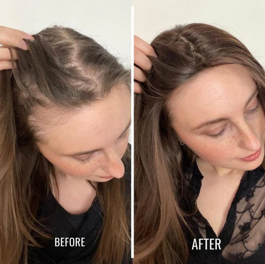 ThickVibe™ Hair Elixir — Unlock Lush, Head-Turning Hair That Feels Alive and Full