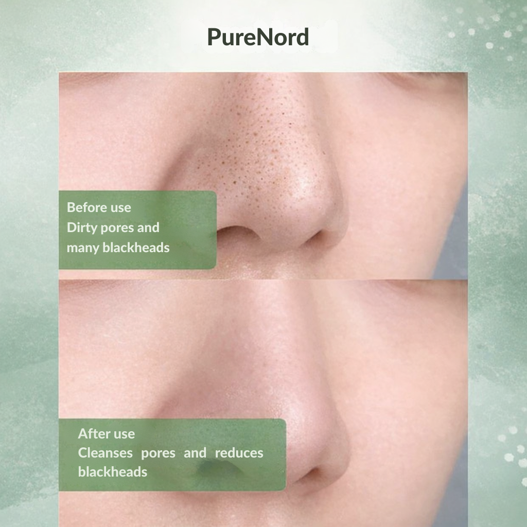 RevitaSoothe™ — Unlock Clear, Calm, and Radiant Skin You’ll Proudly Show Off Every Day