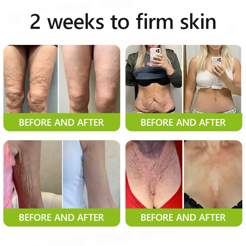 LumaLift™ — Wake Up to Instantly Firmer, Smoother, Radiant Skin That Turns Back Time