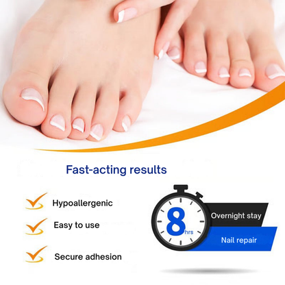 NailGuard Pro™ — Step Into Confidence with Nails That Shine Clear and Strong
