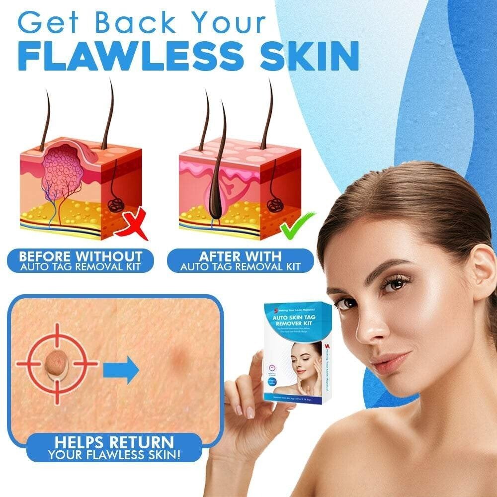 LumaClear™ — Reveal Smooth, Flawless Skin Fast Without Pain or Scars