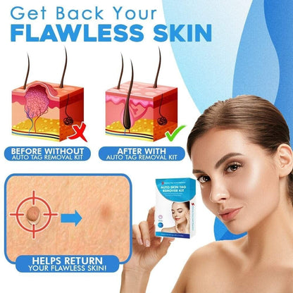 LumaClear™ — Reveal Smooth, Flawless Skin Fast Without Pain or Scars