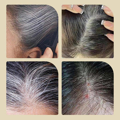 Chromalure™ Precision Comb — Instantly Erase Grays and Own Your Radiance Every Day