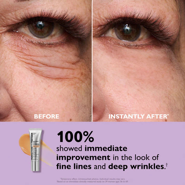 VivaLift™ — Instantly Erase Eye Bags and Wrinkles for a Bold, Youthful Glow