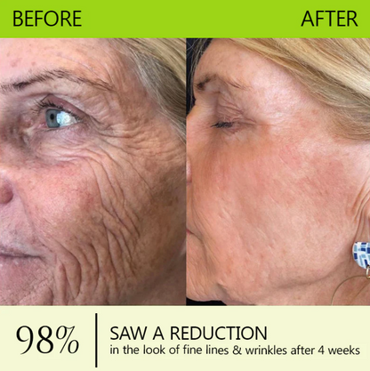 LumaLift™ — Wake Up to Instantly Firmer, Smoother, Radiant Skin That Turns Back Time