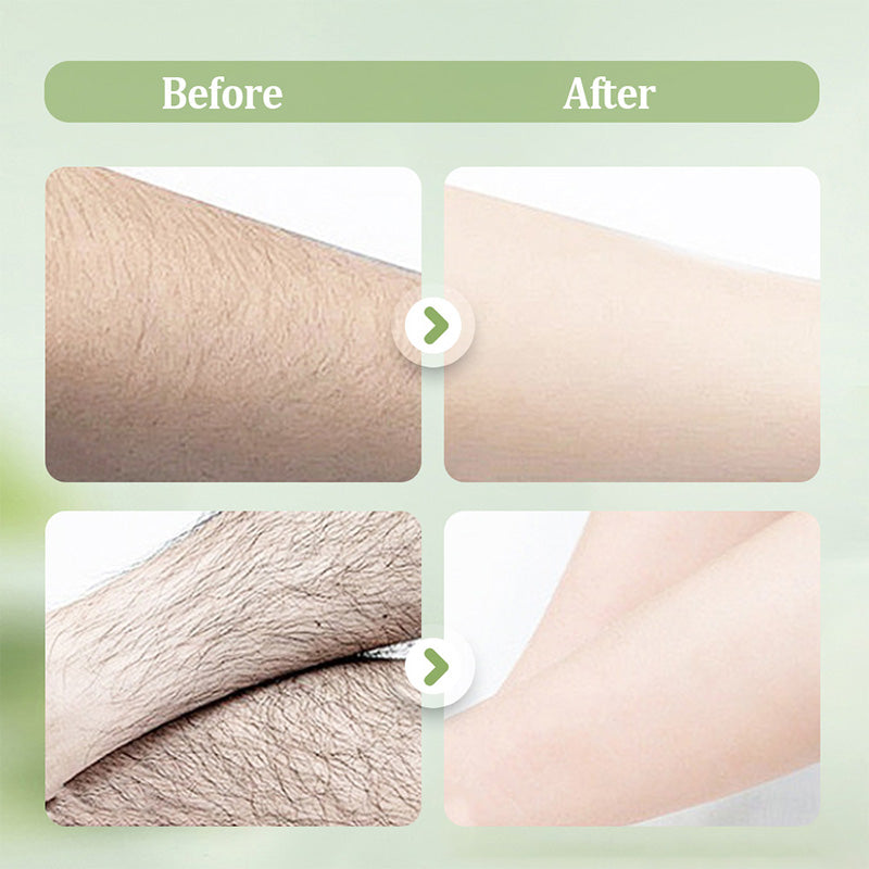 Velvessa™ — Unleash Silky Smooth Skin with Zero Pain and Instant Confidence